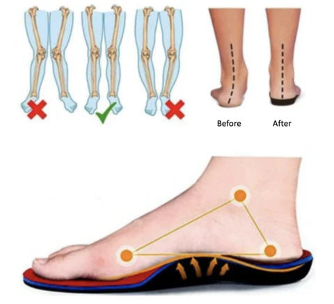 Leonie™ Orthopedic Comfort Flats